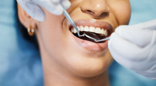 Best Emergency Care for Gum Disease in Woodworth, LA
